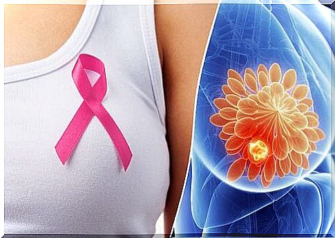 10 signs that indicate breast cancer