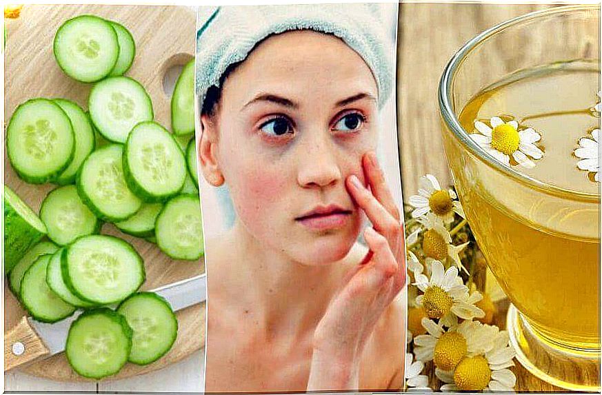 5 natural remedies for dark circles and bags under the eyes