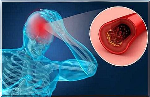 Apoplexy (stroke): risk factors and symptoms