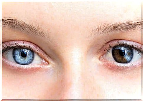 Change in eye color due to diseases