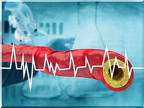 Diet for high cholesterol levels