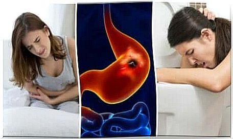 Stomach ulcers