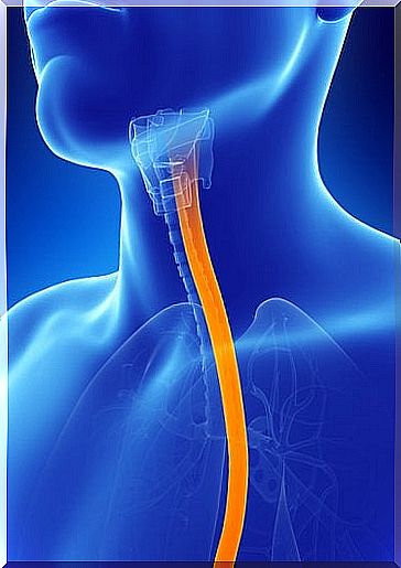 Inflammation of the esophagus: what to do?