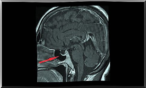 The hormone vasopressin