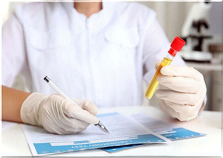 Creatinine levels in the urine