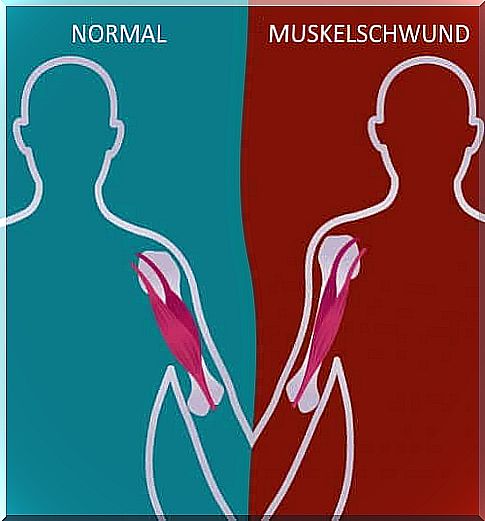 Neuromuscular Diseases: Interesting Facts