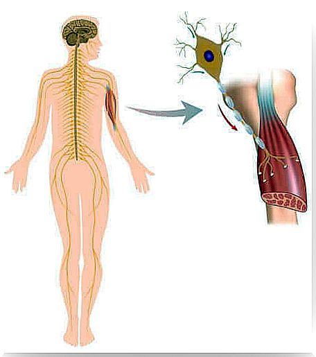 A graphic showing a close-up view of the effects on muscles in neuromuscular diseases