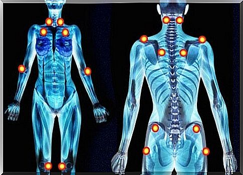 Fibromyalgia points