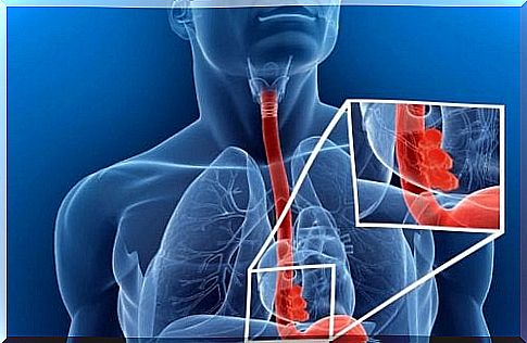 Foreign body in the esophagus