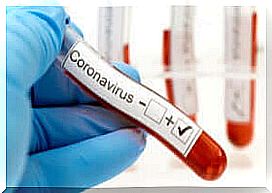 Coronavirus after recovery?