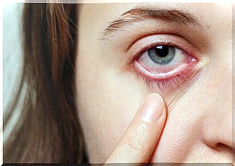 The dry eye syndrome: 5 helpful tips